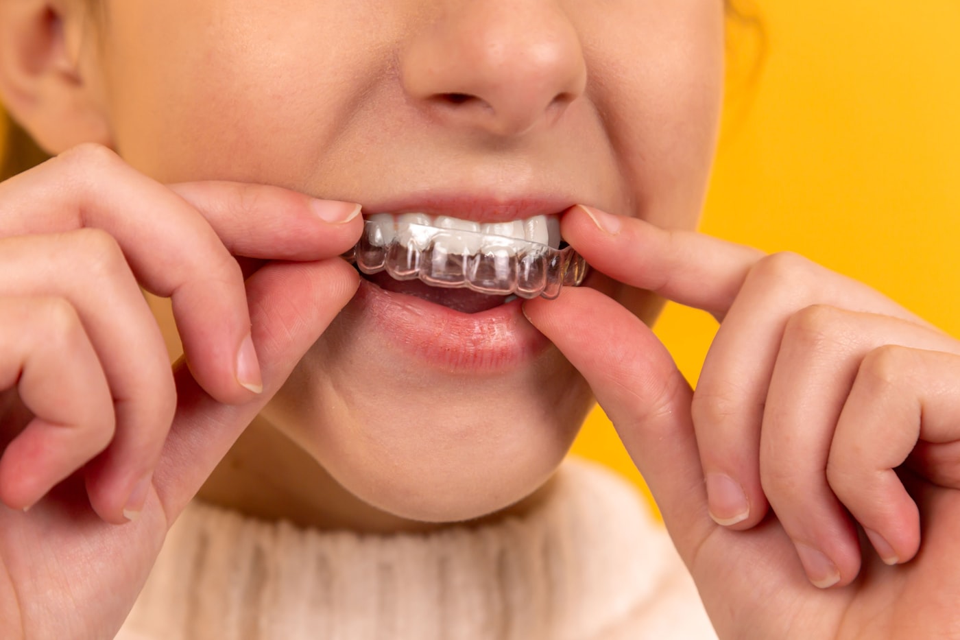 Patient fitting a clear Invisalign aligner